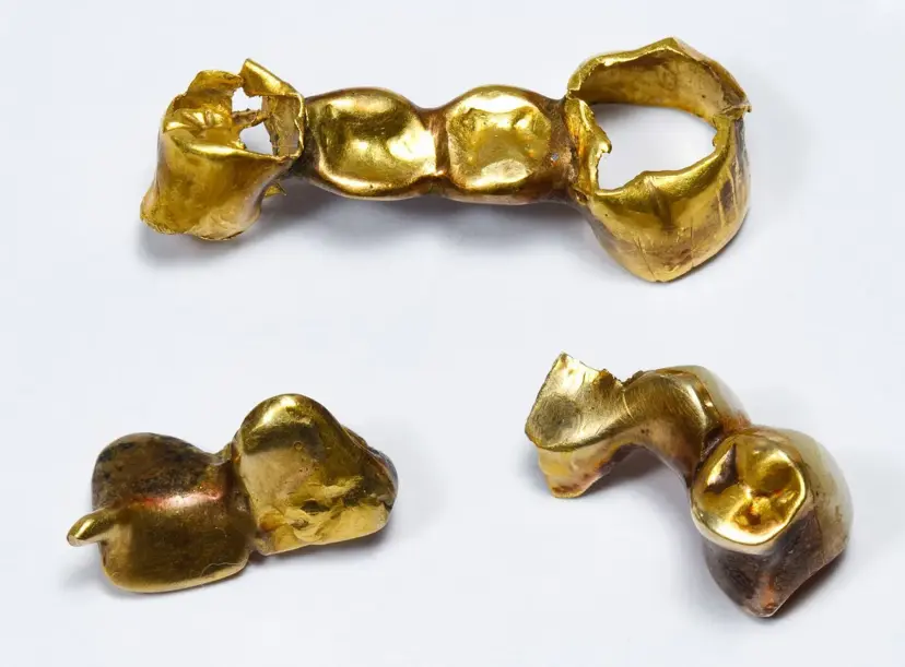 Dental Gold